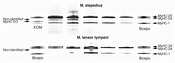 Western blot of human stapedius and tensor tympani middle ear muscle hymogenates blotted with DSHB antibody A4.951 (MyHC-1). PMID: 36914412, Fig. 5.